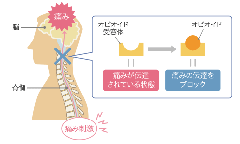 オピオイドを投与のイメージ